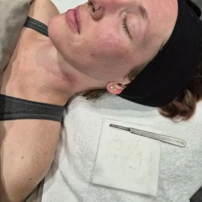 Dermaplaning facial treatment at Cranky Crow Aesthetics in Melbourne FL