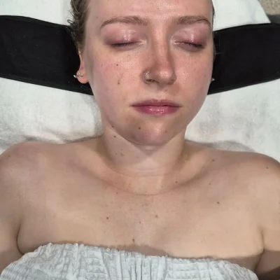 Glowing skin results after esthetic treatment at Cranky Crow Aesthetics in Melbourne Florida